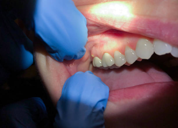 Best Weekend Emergency Dentist in Lexington, MN